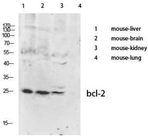 Western blot analysis of various cells using Anti-BCL-2 Antibody at 1:1,000 (4°C overnight) Goat Anti-Rabbit IgG (IRDye 800) was used as a secondary at 1:5,000 (25°C, 1 hour)