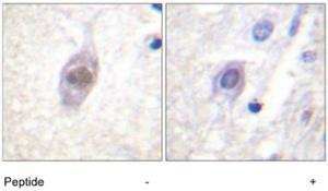 Anti-APC Rabbit Polyclonal Antibody