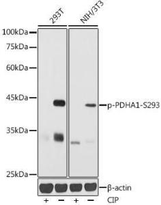 Western blot analysis of extracts of various cell lines, using Anti-PDHA1 (phospho Ser293) Antibody (A306032) at 1:1,000 dilution