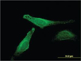 Anti-MB Mouse Monoclonal Antibody [clone: 4F8]