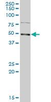 Anti-LYAR Mouse Polyclonal Antibody