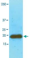 Anti-MYL2 Mouse Monoclonal Antibody [clone: AT3B2]