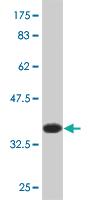 Anti-ULK2 Mouse Monoclonal Antibody [clone: 1A4]