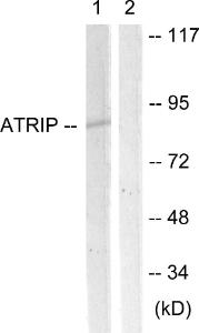 Anti-ATRIP Rabbit Polyclonal Antibody