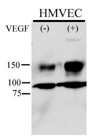 Anti-KDR Rabbit Polyclonal Antibody (Biotin)