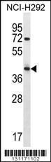 Anti-ARRDC5 Rabbit Polyclonal Antibody (HRP (Horseradish Peroxidase))