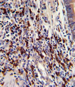 Anti-CNOT8 Rabbit Polyclonal Antibody (PE (Phycoerythrin))