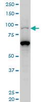 Anti-KAT2B Mouse Monoclonal Antibody [clone: 5E10]