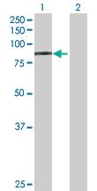 Anti-CD248 Mouse Polyclonal Antibody