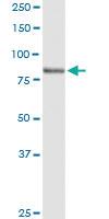 Anti-LRSAM1 Rabbit Polyclonal Antibody