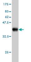 Anti-PDIA5 Mouse Monoclonal Antibody [clone: 3A3]