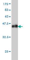 Anti-MAPK6 Mouse Monoclonal Antibody [clone: 1G6]