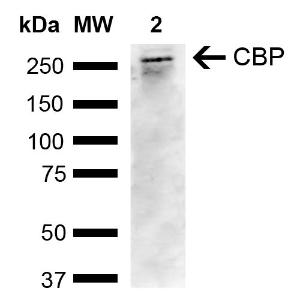 Western blot analysis of human Cervical cancer cell line (HeLa) lysate showing detection of ~265.3 kDa CBP protein using Anti-CREBBP Antibody (A304870) at 1:1,000 for 2 hours at room temperature