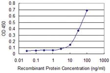 Anti-KAT2B Mouse Monoclonal Antibody [clone: 5E10]