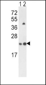 Anti-SAR1A Rabbit Polyclonal Antibody (APC (Allophycocyanin))