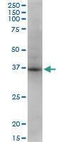 Anti-STX18 Mouse Monoclonal Antibody [clone: 200000]