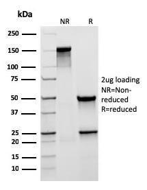 SDS-PAGE analysis of Anti-Mucin 5AC Antibody [rMUC5AC/3779] under non-reduced and reduced conditions; showing intact IgG and intact heavy and light chains, respectively. SDS-PAGE analysis confirms the integrity and purity of the antibody