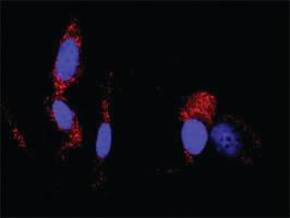 Anti-MAPK3 + DUSP1 Antibody Pair