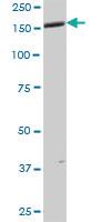 Anti-ANKMY1 Mouse Polyclonal Antibody