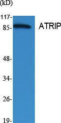 Anti-ATRIP Rabbit Polyclonal Antibody