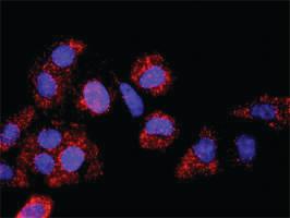 Anti-MAPK3 + DUSP1 Antibody Pair