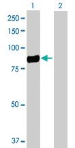 Anti-CD248 Rabbit Polyclonal Antibody