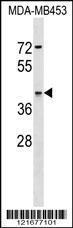 Anti-ARSA Rabbit Polyclonal Antibody (APC (Allophycocyanin))