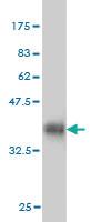 Anti-ULK2 Mouse Monoclonal Antibody [clone: 3H8]