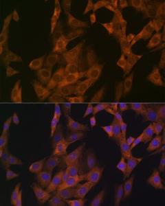 Immunofluorescence analysis of NIH-3T3 cells using Anti-Zyxin Antibody [ARC1906] (A308962) at a dilution of 1:100 (40x lens) DAPI was used to stain the cell nuclei (blue)