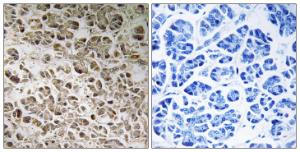 Immunohistochemical analysis of paraffin-embedded human pancreas using Anti-NDUFB1 Antibody. The right hand panel represents a negative control, where the antibody was pre-incubated with the immunising peptide