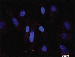 Anti-MAPK3 + DUSP1 Antibody Pair