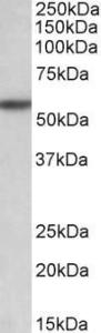 Anti-TGFBR1 antibody