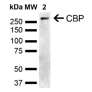 Western blot analysis of human Cervical cancer cell line (HeLa) lysate showing detection of ~265.3 kDa CBP protein using Anti-CREBBP Antibody (A304871) at 1:1,000 for 2 hours at room temperature