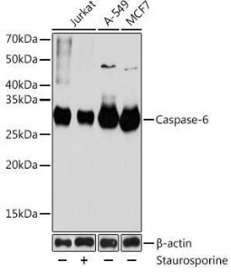 Western blot analysis of extracts of various cell lines, using Anti-Caspase-6/CASP-6 Antibody [ARC0031] (A306034) at 1:1,000 dilution Jurkat cells were treated by Staurosporine(1uM) at room temperature for 3 hours