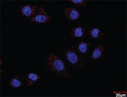 Anti-MAPK3 + DUSP1 Antibody Pair