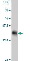 Anti-ULK2 Mouse Monoclonal Antibody [clone: 5E4]