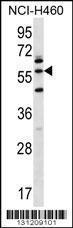 Anti-LETM2 Rabbit Polyclonal Antibody (HRP (Horseradish Peroxidase))