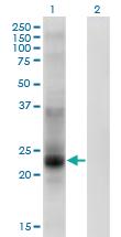 Anti-TSPAN8 Mouse Monoclonal Antibody [clone: 1E5]