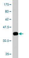 Anti-UBE3A Mouse Monoclonal Antibody [clone: 2F6]