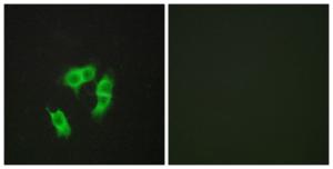 Immunofluorescence analysis of HepG2 cells using Anti-ARMX3 Antibody. The right hand panel represents a negative control, where the Antibody was pre-incubated with the immunising peptide