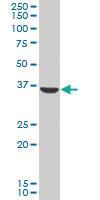 Anti-AKR1C2 Mouse Polyclonal Antibody