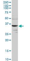 Anti-MMACHC Rabbit Polyclonal Antibody