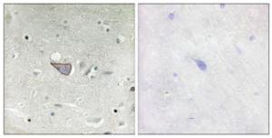 Immunohistochemical analysis of paraffin-embedded human brain tissue using Anti-ARMX3 Antibody. The right hand panel represents a negative control, where the Antibody was pre-incubated with the immunising peptide