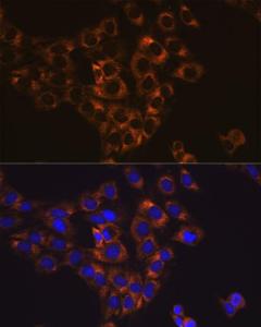 Immunofluorescence analysis of C6 cells using Anti-Caspase-6/CASP-6 Antibody [ARC0031] (A306034) DAPI was used to stain the cell nuclei (blue)