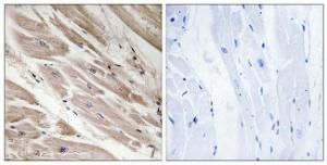 Immunohistochemical analysis of paraffin-embedded human heart tissue using Anti-MYBPC3 Antibody. The right hand panel represents a negative control, where the antibody was pre-incubated with the immunising peptide