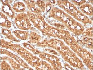 Immunohistochemical analysis of formalin-fixed, paraffin-embedded human renal cell carcinoma using Anti-CD134 Antibody [OX40/3108]