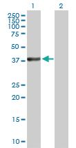 Anti-MAP2K3 Rabbit Polyclonal Antibody