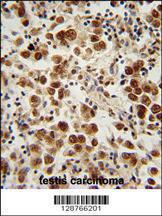 Anti-SOHLH1 Rabbit Polyclonal Antibody (FITC (Fluorescein Isothiocyanate))