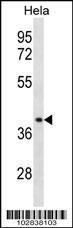 Anti-CCBP2 Rabbit Polyclonal Antibody (Biotin)