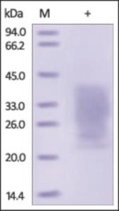 The purity of rh PTH1R / PTHR1 was determined by DTT-reduced (+) SDS-PAGE and staining overnight with Coomassie Blue.